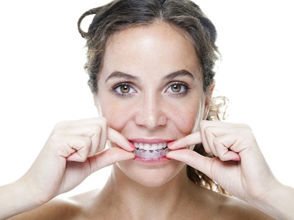 Luôn đeo khay niềng và chỉ tháo ra khi ăn uống và vệ sinh Chi phí niềng răng không mắc cài invisalign - Nha khoa Platinum