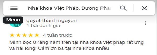 Đánh giá của khách hàng sau khi sử dụng dịch vụ tại nha khoa Việt Pháp