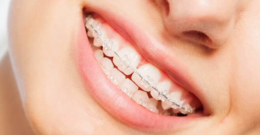 Khi sử dụng có bị ố vàng hay không ?