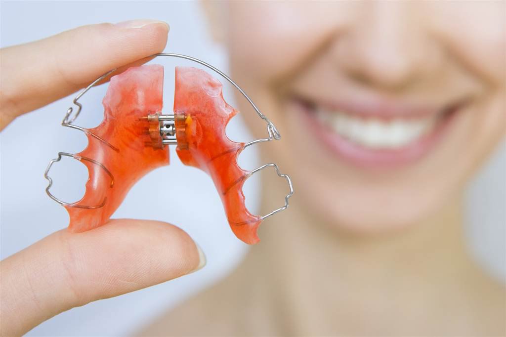 Sau niềng răng bằng khay trong suốt vẫn phải đeo hàm duy trì để bảo đảm kết quả chỉnh nha
