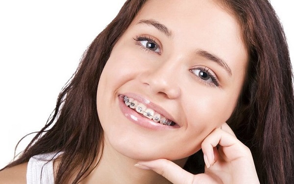 Khắc phục niềng răng bị hóp má như thế nào?