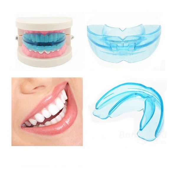 Bộ niềng răng tại nhà