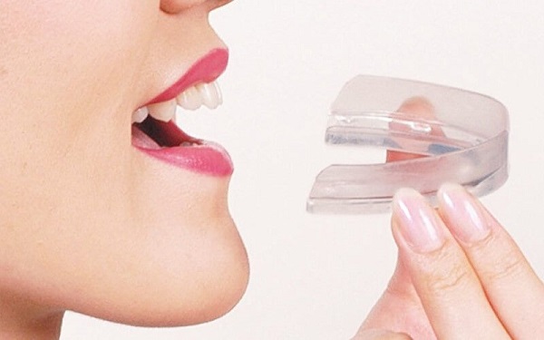 Giải pháp làm răng hết hô tại nhà bằng sử dụng niềng răng tháo lắp