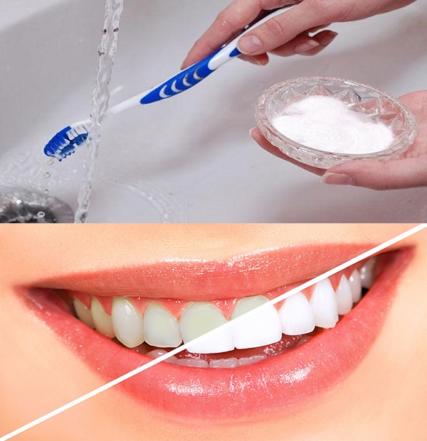 Hút thuốc lá - nguyên nhân gây nên tình trạng vàng ố ở răng