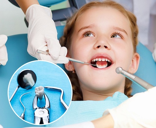 Không chú ý đến khám răng cho bé sẽ gây mất thẩm mỹ và ảnh hưởng sức khoẻ răng miệng sau này