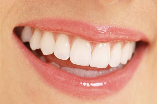 Có thể trám răng khi răng sứ bể hay không?