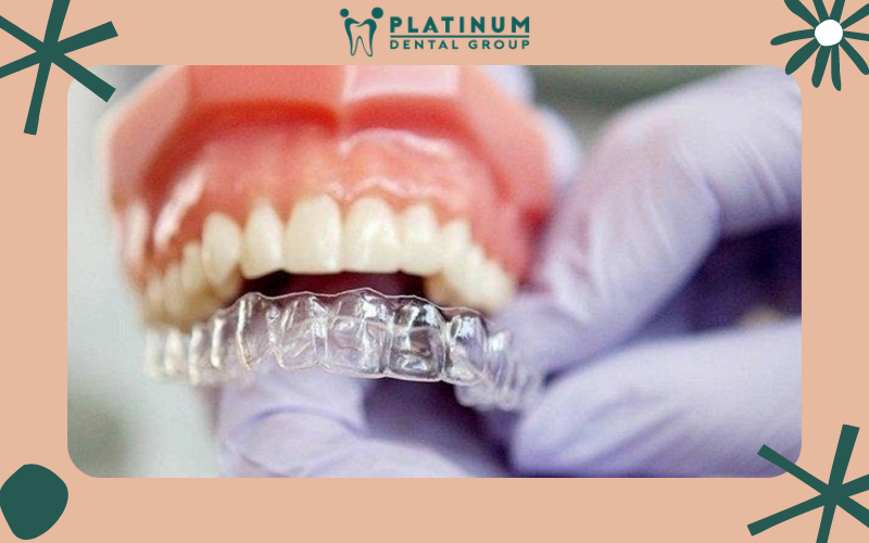 Nha sĩ hướng dẫn cách vệ sinh niềng răng trong suốt đúng chuẩn