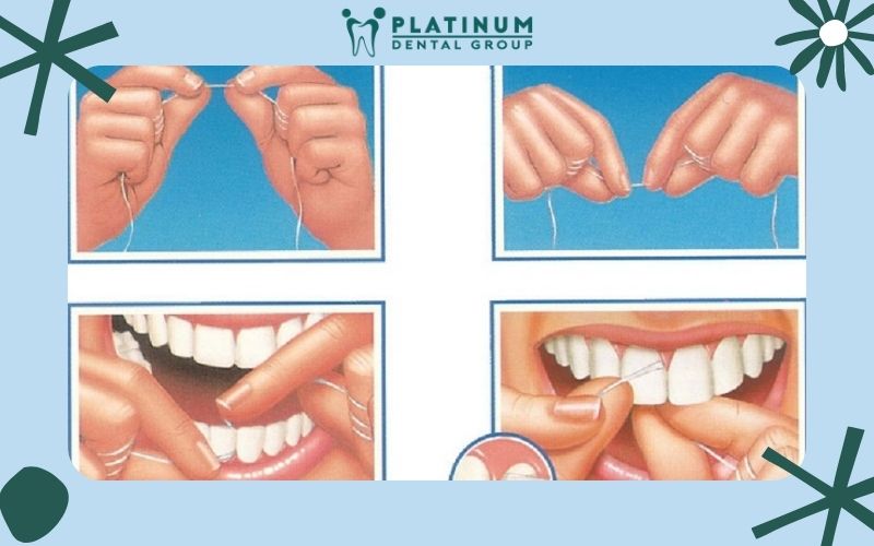 Các bước sử dụng chỉ nha khoa