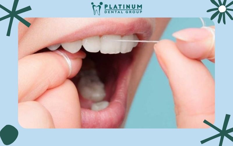 Cách sử dụng chỉ nha khoa đúng nhất