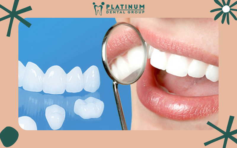 Nguyên nhân và cách khắc phục khi răng giả bị hôi