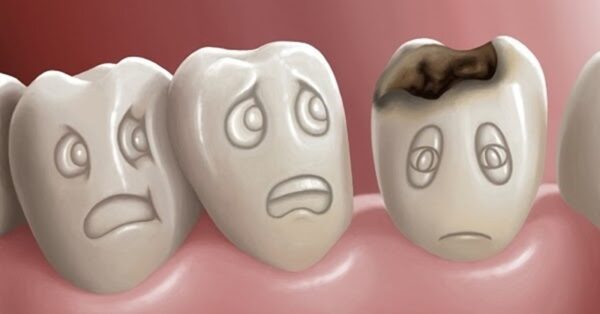 Xiết ăn răng sẽ khiến trẻ đau nhức vô cùng khó chịu