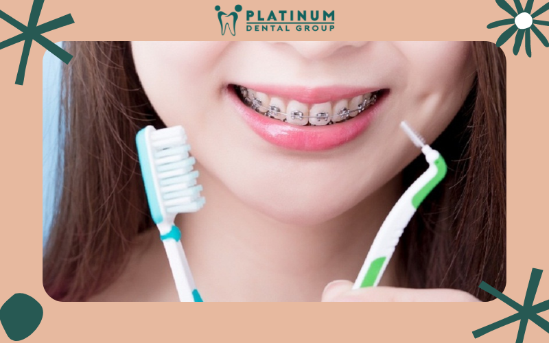 Vệ sinh răng miệng đúng cách sau niềng răng