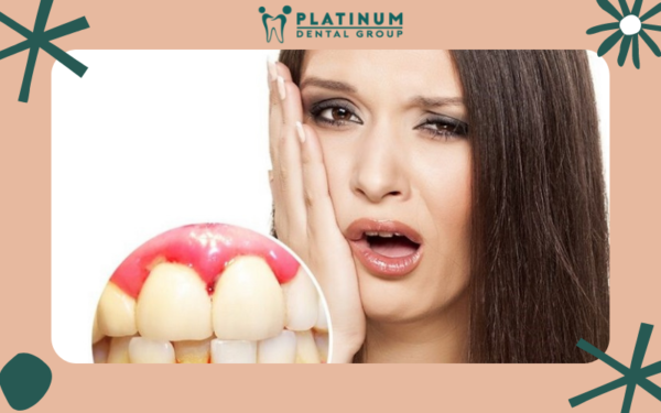 Những biến chứng nguy hiểm của bệnh chảy máu chân răng