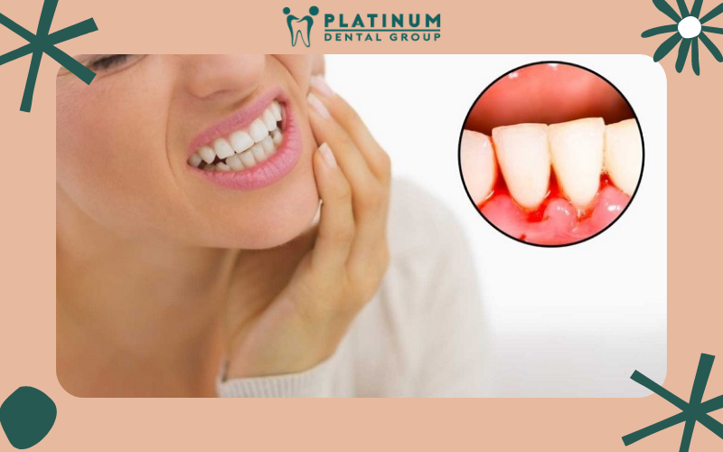 Bệnh chảy máu chân răng có thể phát hiện sớm không? Bệnh chảy máu chân răng có thể phát hiện sớm không?