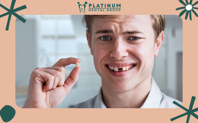 Lí do tại sao lại bị rụng răng sớm?