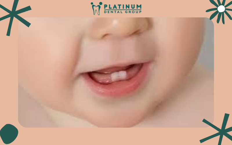 Trẻ mọc răng chậm nguy hiểm không?