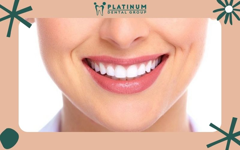 Niềng răng giúp khách hàng cải thiện được nụ cười của mình
