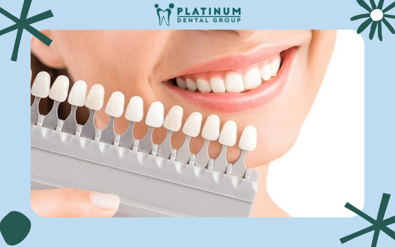 Những lưu ý để duy trì độ bền và trắng sáng của răng sứ Titan