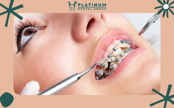 bat-vit-nieng-rang-1-600x375