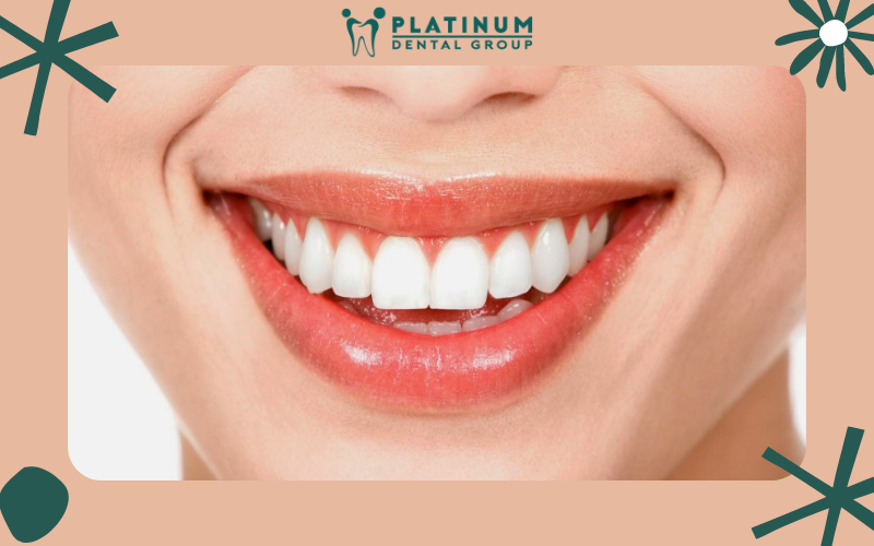 Vì sao cần phải đánh bóng hàm sau khi cạo vôi răng