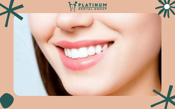 Bọc răng sứ chất lượng đem lại nụ cười trắng sáng