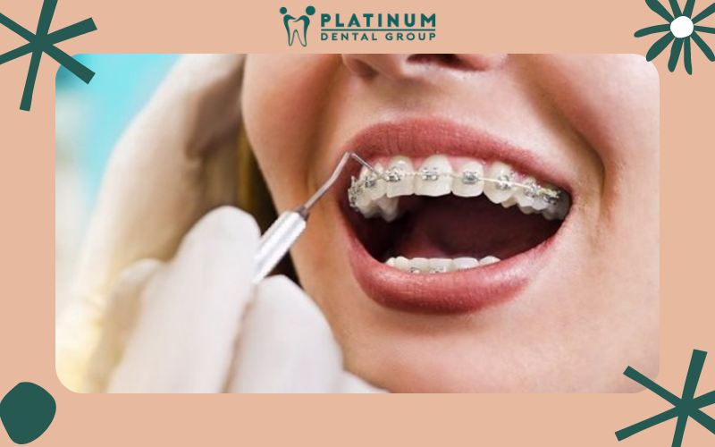 Bác sĩ thực hiện sai kỹ thuật