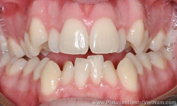 Các Vấn Đề Thường Gặp