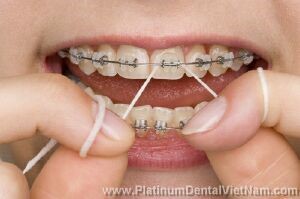 Chỉ nha khoa làm từ nylon nhân tạo có phủ sáp
