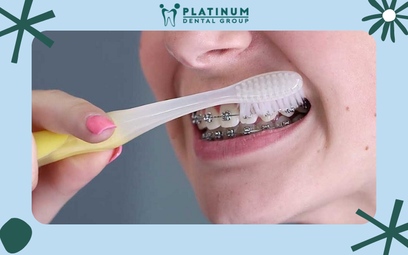 Không nên chải răng quá thường xuyên vì có thể gây hại đến các men răng, làm hao mòn men răng