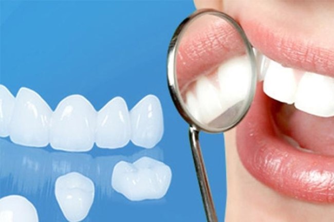 rang-su-zirconia-co-tot-khong-dac-diem-noi-bat-la-gi-2