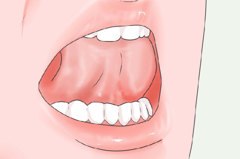 Một trong những bước quan trọng của phương pháp Mewing là đặt lưỡi phía sau răng và cong về phía vòm trên.