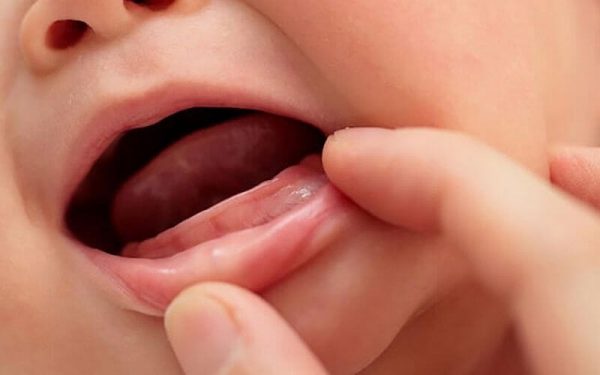 Răng sữa mọc chậm cũng là vấn đề mà các bậc cha mẹ nên lưu ý nhiều hơn trong quá trình phát triển của trẻ Răng sữa mọc chậm cũng là vấn đề mà các bậc cha mẹ nên lưu ý nhiều hơn trong quá trình phát triển của trẻ