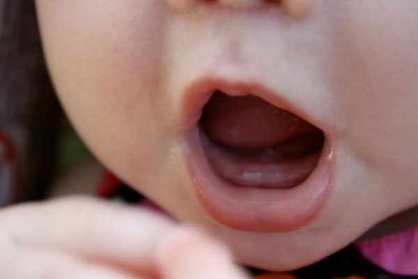 Có rất nhiều nguyên nhân dẫn đến việc trẻ mọc răng chậm, các mẹ cần tìm hiểu rõ nguyên nhân trước khi tìm đến phương pháp điều trị thích hợp Có rất nhiều nguyên nhân dẫn đến việc trẻ mọc răng chậm, các mẹ cần tìm hiểu rõ nguyên nhân trước khi tìm đến phương pháp điều trị thích hợp