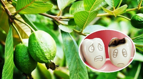 Lá ổi non giã nát kèm với muối chính là “ khắc tinh” của chứng bệnh sâu răng) 