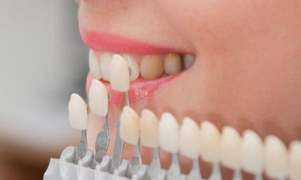 Bọc răng sứ là một phương pháp hay được sử dụng để giải quyết tình trạng răng cửa to bằng cách mà nhở răng và bọc sứ. Bọc răng sứ là một phương pháp hay được sử dụng để giải quyết tình trạng răng cửa to bằng cách mà nhở răng và bọc sứ.