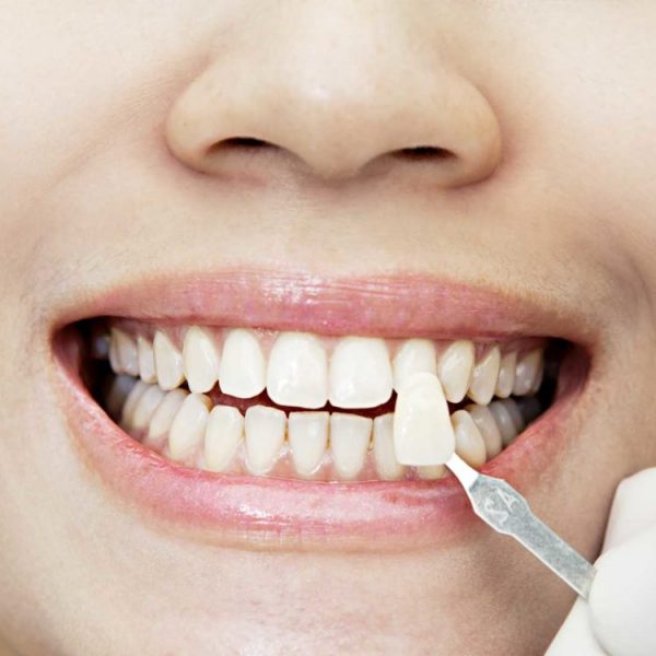 Khi xác định lựa chọn phương pháp để cải thiện tình trạng móm, cần xác định rõ nguyên nhân và tình trạng móm.