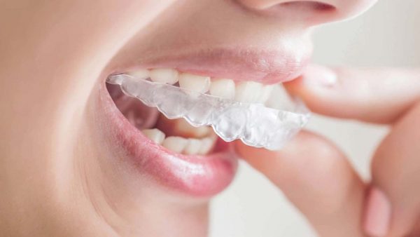 Niềng răng Invisalign có tốt không, sự thật được tiết lộ từ chuyên gia nha khoa Platinum Niềng răng Invisalign có tốt không, sự thật được tiết lộ từ chuyên gia nha khoa Platinum