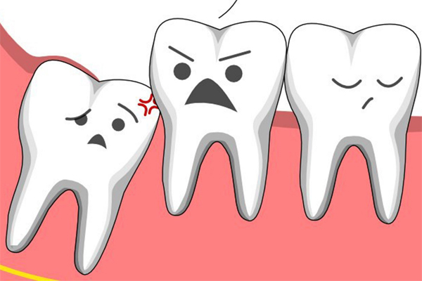 Trường hợp nào cần và không cần nhổ răng hô?