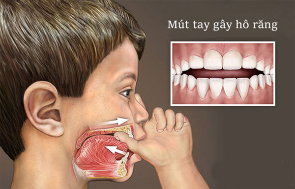 Nguyên nhân do thói quen sinh hoạt
