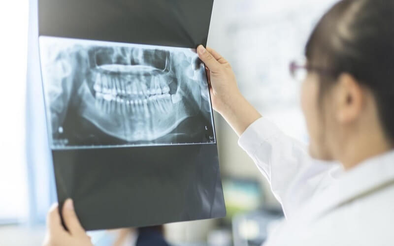 Thăm khám và chụp X-Quang răng trước khi niềng Thăm khám và chụp X-Quang răng trước khi niềng