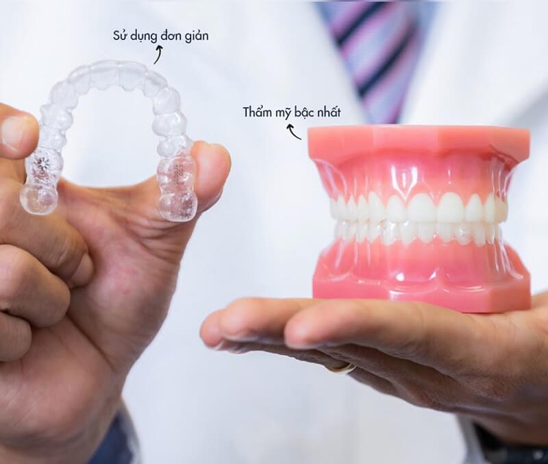 Sản xuất khay niềng răng tại Hoa Kỳ Sản xuất khay niềng răng tại Hoa Kỳ