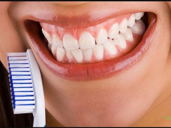 Tam giác nướu thường xuất hiện sau khi niềng răng