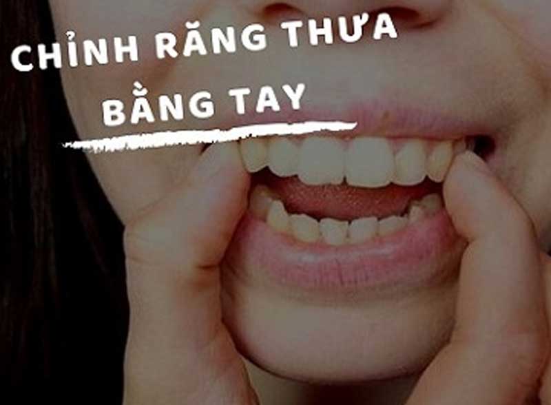 Điều trị răng thưa tại nhà bằng lực bàn tay