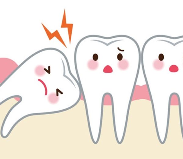 Ăn thức ăn mềm như cháo sau khi nhổ răng