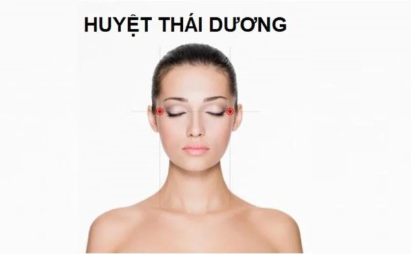 Hóp thái dương khi niềng răng