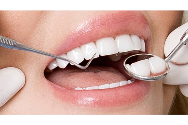Minh họa ưu nhược điểm của bọc răng sứ