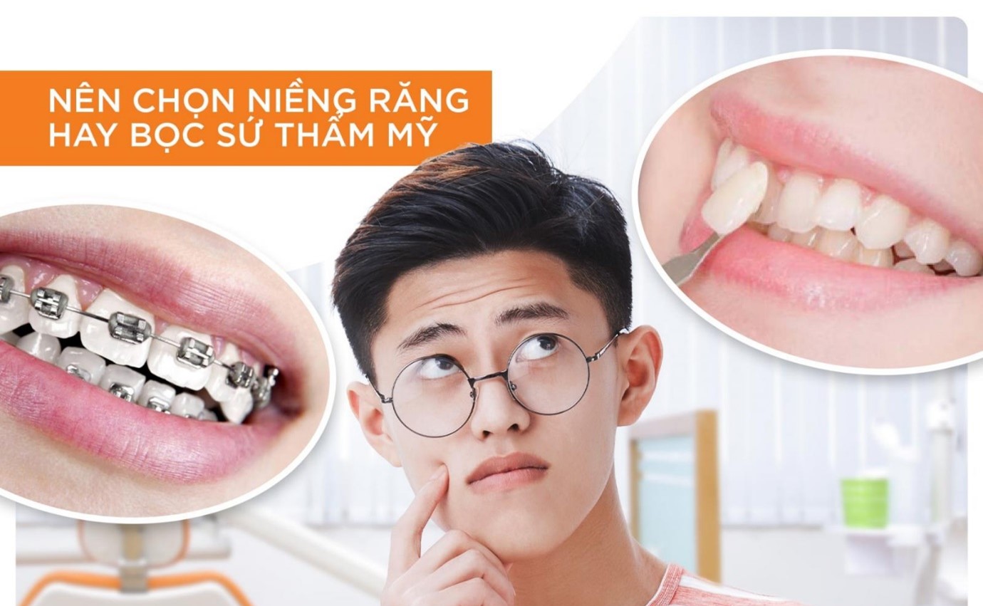 Lựa chọn niềng răng hay bọc răng sứ