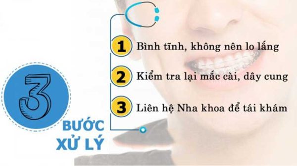 Lỡ nuốt niềng răng làm bạn lo lắng