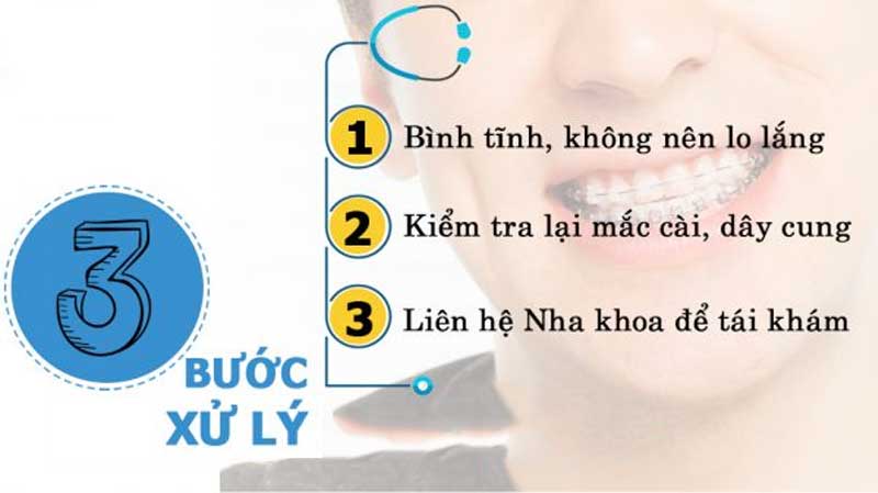 Lỡ nuốt niềng răng làm bạn lo lắng