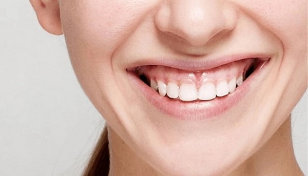 Các bệnh về nướu gây đau răng nên chườm nóng hay lạnh?